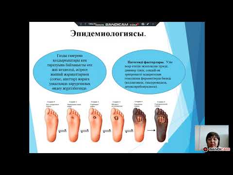 Видео: Анаэробты жарақатты инфекция қоздырғыштары / Қожалимова А.А.