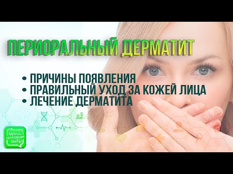 Видео: Периоральный дерматит | Здорово здоровым быть