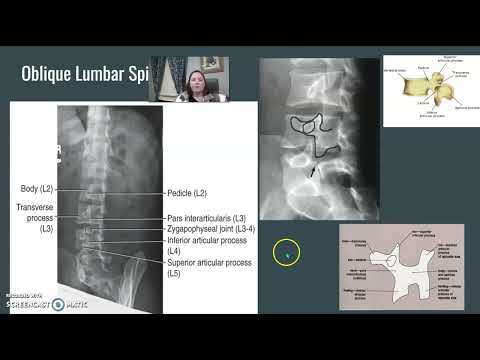 Видео: Основы критики рентгеновских снимков позвоночника