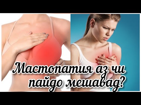 Видео: МАСТОПАТИЯ. ТАРЗИ ТАБОБАТ. ЧИ КОР БОЯД КАРД? #мастопатия #хаётисолим #табобат