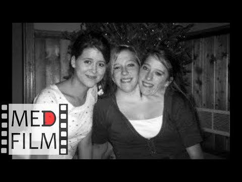 Видео: (1) Сиамские близнецы, академик К.В. Судако́в © (1) Siamese twins