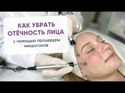 Видео: Как убрать отёчность лица с помощью процедуры микротоки