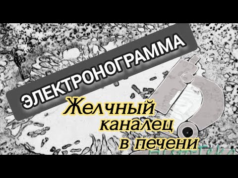 Видео: ЖЕЛЧНЫЙ КАНАЛЕЦ В ПЕЧЕНИ (электронограмма)