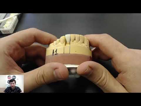 Видео: Раскрашивание коронки E.MAX
