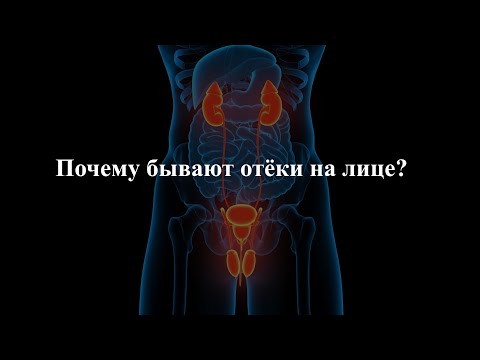 Видео: Почему бывают отёки на лице? 
