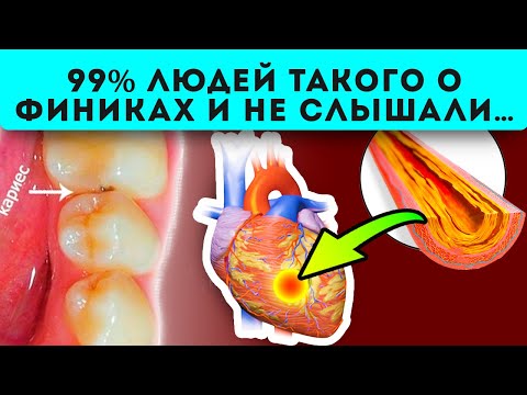 Видео: Вот так меняется тело, после поедания фиников | Финики – польза и вред для организма