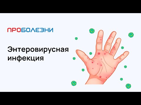 Видео: Энтеровирусная инфекция