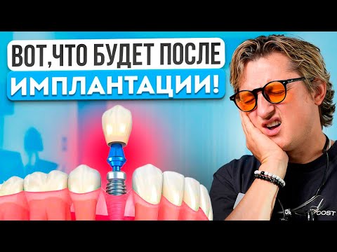 Видео: Это случится ПОСЛЕ ИМПЛАНТАЦИИ! Скорее смотри, чтобы быть готовым к последствиям!