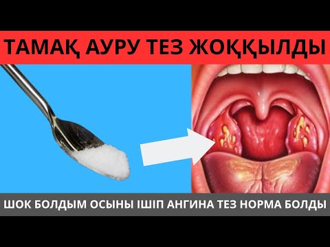 Видео: 1 ҚАСЫҚ ТАМАҚ АУРУЫН ТЕЗ ЖОҚ ҚЫЛДЫ. ОСЫДАН СОҢ ТАМАҚ АУРУЫН ҰМЫТТЫМ. тамақ ауырғанда не істеу керек