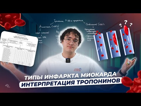 Видео: Типы инфаркта миокарда. Интерпретация тропонина