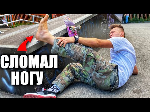 Видео: Я СЛОМАЛ НОГУ НА СКЕЙТЕ В СКЕЙТ-ПАРКЕ!