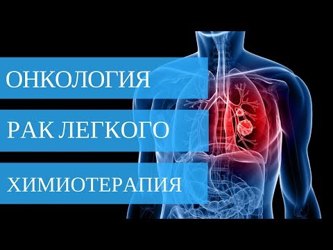 Видео: РАК ЛЕГКОГО - химиотерапия. МЕЛКОКЛЕТОЧНЫЙ РАК ЛЕГКОГО