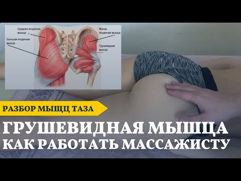 Видео: Синдром грушевидной мышцы | Защемление седалищного нерва | Диагностика