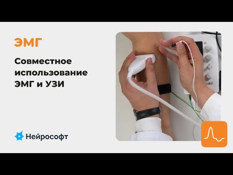 Видео: ЭМГ: совместное использование ЭМГ и УЗИ в клинической практике