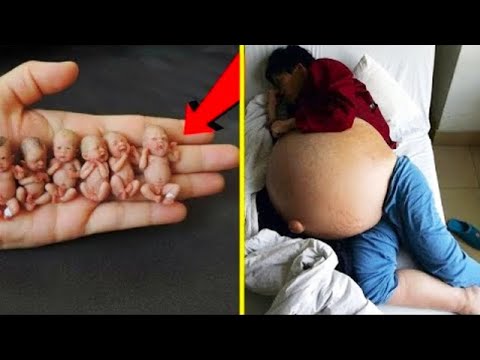 Видео: Необычные Роды, в Которые Не Поверили Даже Врачи! Топ 10