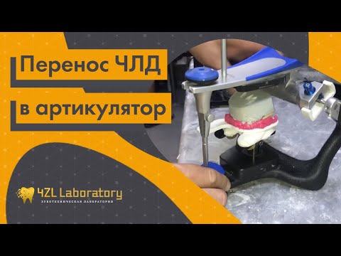 Видео: Перенос ЧЛД в артикулятор. Загипсовка моделей в артикулятор