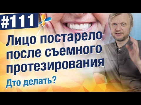Видео: Куда исчезли губы? Как съёмные протезы меняют внешность