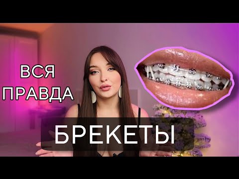 Видео: БРЕКЕТЫ — МОЯ ИСТОРИЯ: СТОИМОСТЬ, ПОДВОДНЫЕ КАМНИ, ГИГИЕНА, ОБЕЩАНИЯ, РЕЗУЛЬТАТЫ НА СЕГОДНЯ. Часть 1