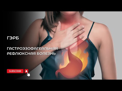 Видео: ГЄРБ.  Гастроэзофагеальная рефлюксная болезнь. Малиновская