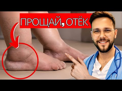 Видео: Лучший витамин для снятия воспаления и отёков в ногах и лодыжках