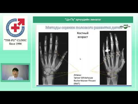 Видео: Тестостерон ба бэлгийн бойжил