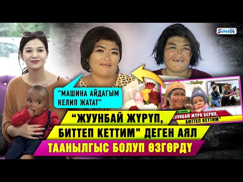 Видео: “Жуунбай жүрүп, биттеп кеттим” деген аял таанылгыс болуп өзгөрдү