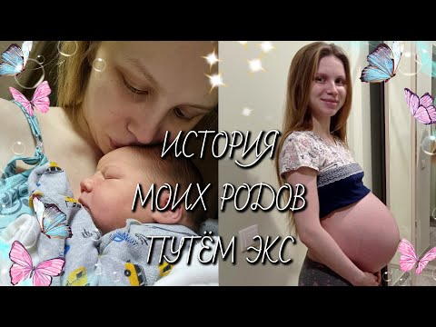 Видео: 🩵МОЯ ИСТОРИЯ РОДОВ! КЕСАРЕВО СЕЧЕНИЕ.🩵
