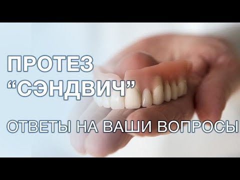 Видео: Что такое сэндвич протезы? Особенности протезирования, плюсы и минусы