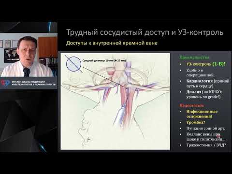 Видео: Трудный сосудистый доступ В.В.Кузьков