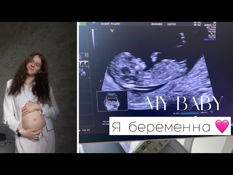 Видео: Я беременна🩷