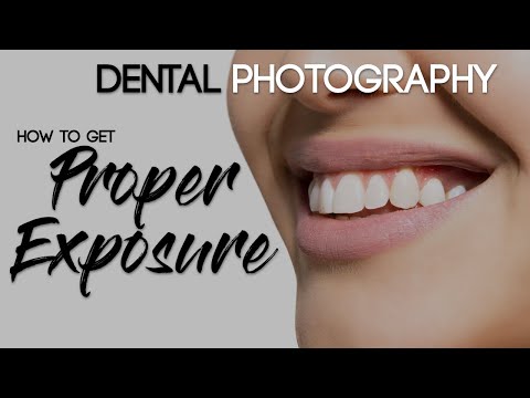 Видео: Основы дентальной фотографии: как сделать качественный дентальный снимок — правильная экспозиция