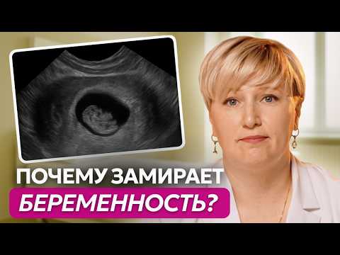 Видео: Замершая беременность: причины, симптомы и что делать дальше