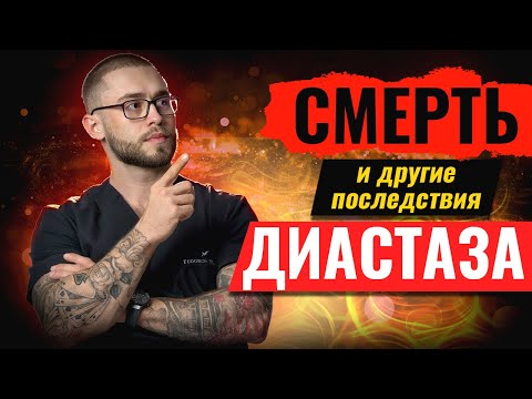 Видео: ДИАСТАЗ ЖИВОТА l ЧТО ВАМ ПОМОЖЕТ l ПРОФИЛАКТИКА и ЛЕЧЕНИЕ