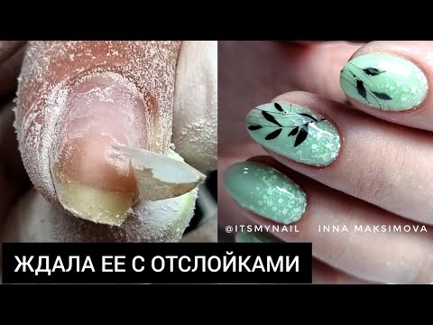 Видео: результат НА ЛИЦО - ОТСЛОЙКИ