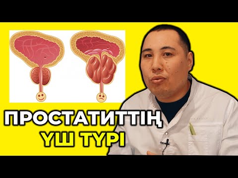 Видео: Простатит емдеу жолдары! Созылмалы простатиттің қауіптілігі! Простатиттің негізгі үш түрі!