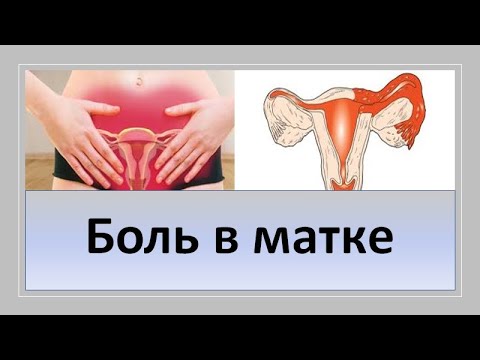 Видео: Боль в матке.