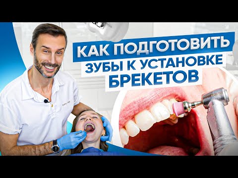 Видео: Подготовка зубов к установке брекетов у реального пациента клиники OrthoLike