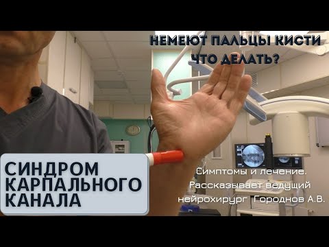 Видео: СИНДРОМ КАРПАЛЬНОГО КАНАЛА. Почему немеют пальцы?