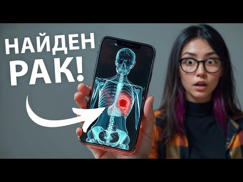Видео: Как НЕЙРОСЕТЬ спасает жизни?! Личный доктор в твоем смартфоне