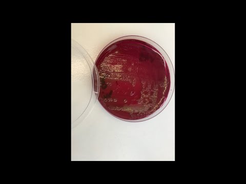 Видео: Кишечная палочка — Escherichia coli (E. coli). Методы лабораторной диагностики (посев, определение)