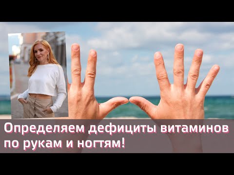 Видео: О каких дефицитах могут рассказать ваши руки? | Нутрициолог | Дефициты витаминов без анализов