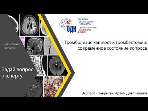 Видео: Тромболизис как мост к тромбэктомии: современное состояние вопроса