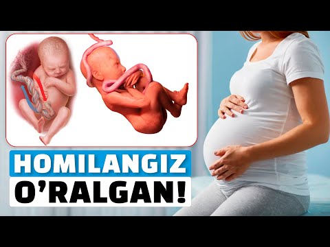Видео: ҲОМИЛА КИНДИГИГА ЎРАЛИШИ. ОНАЛАРНИНГ ХАТОСИ НИМАДА?