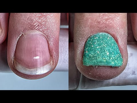 Видео: СЕКРЕТЫ ДИП СИСТЕМЫ ✅ АЛЛЕРГИЯ НА ГЕЛЬ ЛАК