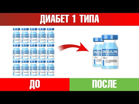 Видео: Диабет 1 типа👉Все, что нужно знать для снижения дозы инсулина