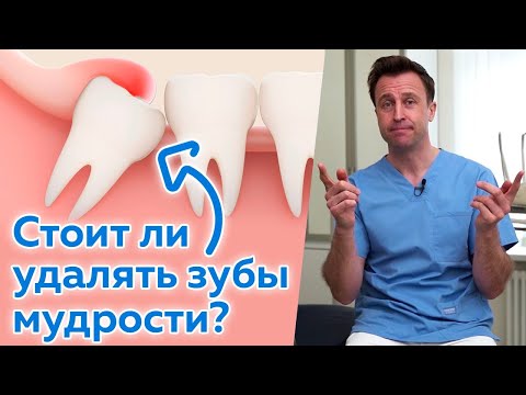 Видео: Нужно ли удалять зубы мудрости? / Где расположены зубы мудрости?