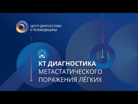 Видео: КТ диагностика метастатического поражения лёгких