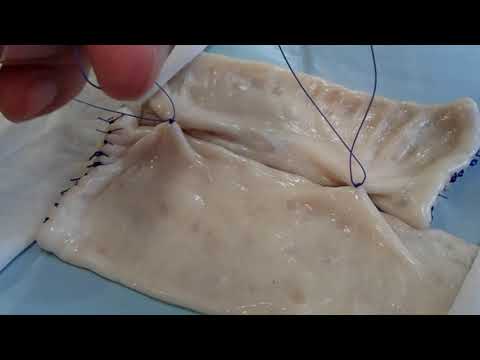 Видео: Кишечный анастомоз бок-в-бок