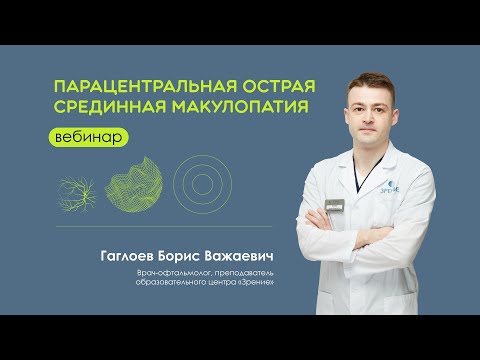 Видео: Парацентральная острая срединная макулопатия
