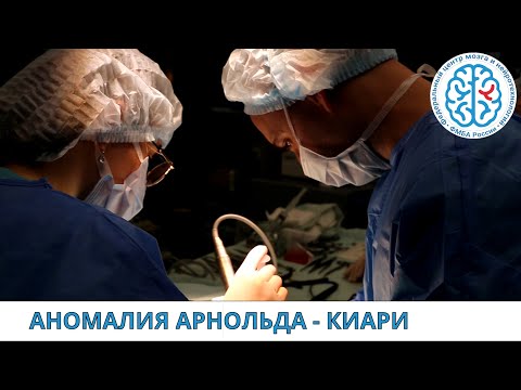 Видео: Аномалия Арнольда-Киари и её лечение в Федеральном центре мозга и нейротехнологий. История пациента.
